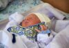 В Николаевской области за неделю родилось 87 малышей