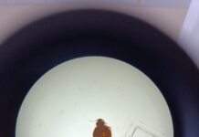 В Николаеве жительница полгода лечилась зря: причина – постельные клопы, — ФОТО